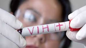 vih sida