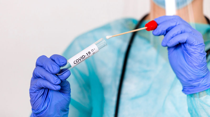 2601 Prueba PCR COVID scale