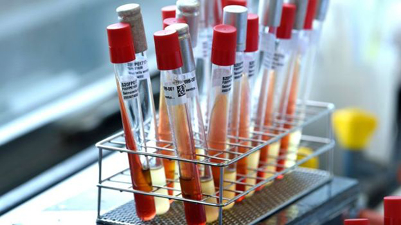 coronavirus eeuu 2