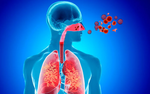 infección respiratoria aguda