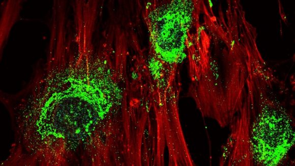 tecnologia tejido oseo 580x327