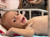 Genocidio en Gaza: cada día más de 100 niños enfrentan riesgo de desnutrición