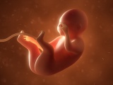 Caso extremadamente raro: extraen dos 'gemelos parásitos' del abdomen de una bebé